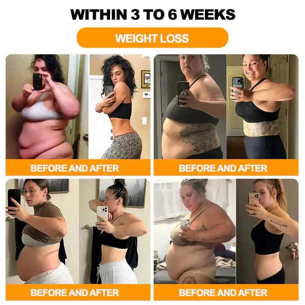 🌿Bee Venom Lymphatic Daiamage & Sliming Patches 🔥(Buy 1 Get 1 Free)🔥